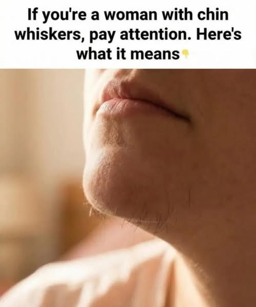 What Chin Hair in Women Really Says About Horm:ones