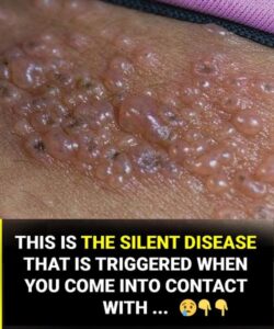 What few people know about this silent disease that can appear without warning