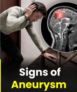 Warning Signs of Aneurysm in Men: What You Should Never Ignore