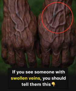 What the Veins on Your Hands Might Reveal About Your Heart Health