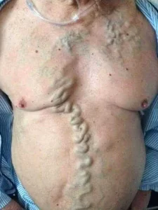 What Those Red Spots on Your Skin Really Mean: A Guide to Knowing When to Worry