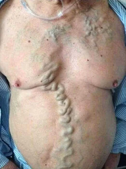 What Those Red Spots on Your Skin Really Mean: A Guide to Knowing When to Worry