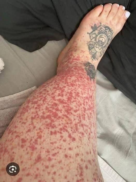 💔 These Are the Emotional Consequences of Intimacy Without Alignment—And How to Protect Your Peace