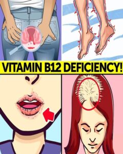8 Strange (But Real) Signs Your Body Is Begging for More Vitamin B12 – Don’t Ignore These Red Flags