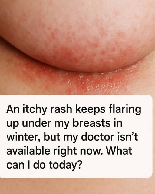 An itchy rash keeps flaring up under my breasts in winter, but my doctor isn’t available right now. What can I do today?