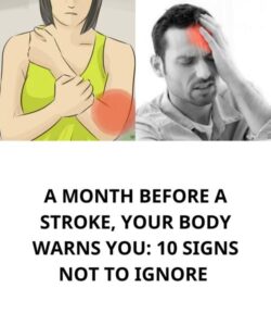 A Month Before a Stroke, Your Body Warns You: 10 Signs Not to Ignore