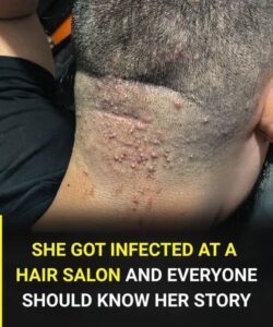 Hair salon alert: a common infection after a haircut and how to prevent it