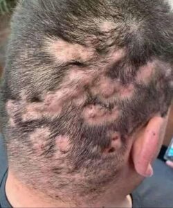 These are the first symptoms