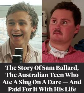 The Story Of Sam Ballard, The Australian Who Ate A Slug On A Drunken Dare And Died Because Of It