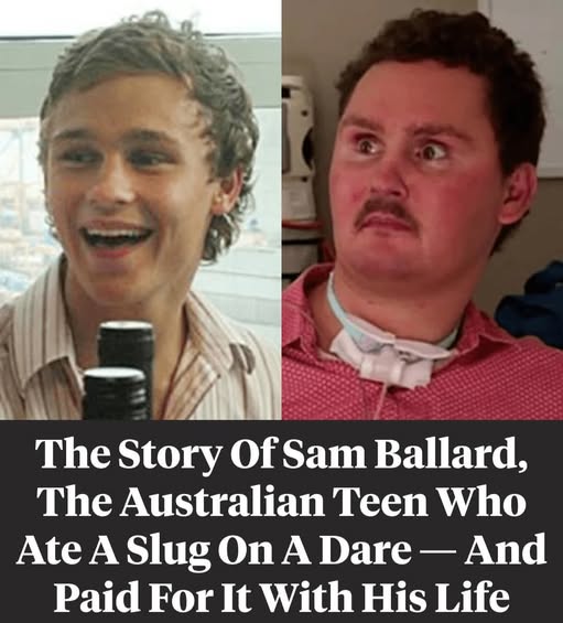 The Story Of Sam Ballard, The Australian Who Ate A Slug On A Drunken Dare And Died Because Of It