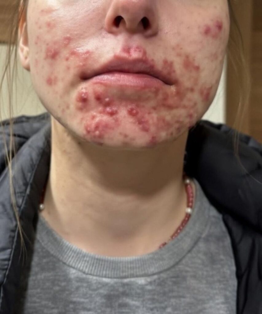 These are the first symptoms of sleeping with…