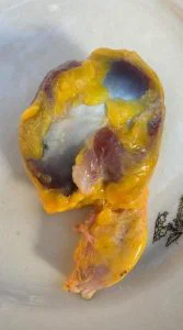 Did you know that if you eat chicken gizzards you don’t have to take…See More.