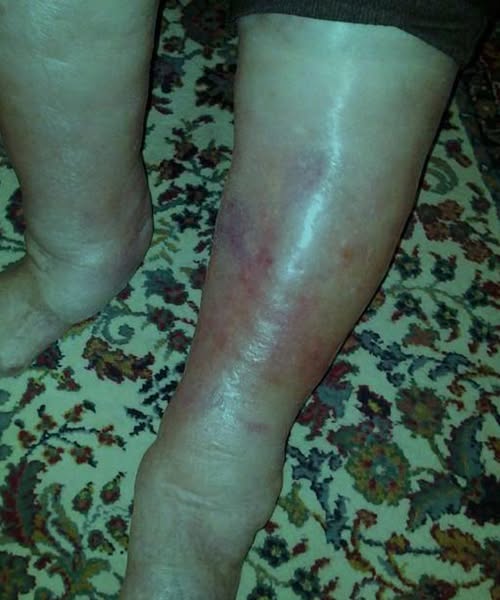 Why a simple skin blemish could be more dang:erous than you think