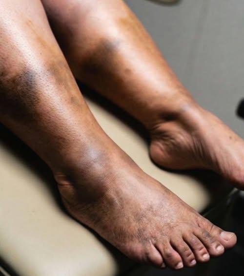 These are the consequences of sleeping with a… See more