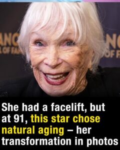 At 91, this legendary actress still turns heads after a facelift – see her transformation