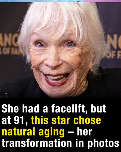 At 91, this legendary actress still turns heads after a facelift – see her transformation
