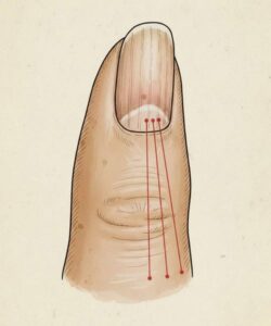 If you have these lines on your nails, you should pay attention.