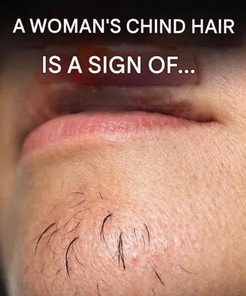 How Stress and Diet Affect Chin Hair Growth in Women