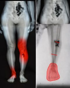 Understanding Health Concerns After Illness! What Older Adults Should Know!