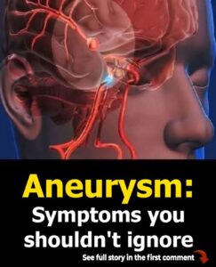 12 Early Warning Signs of an Aneurysm You Shouldn’t Ignore