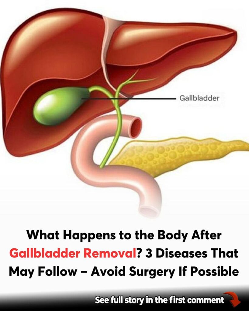 What to Expect After Gallbladder Surgery: Side Effects and Dietary Tips