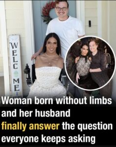 Woman born without limbs and her husband finally answer the question everyone keeps asking