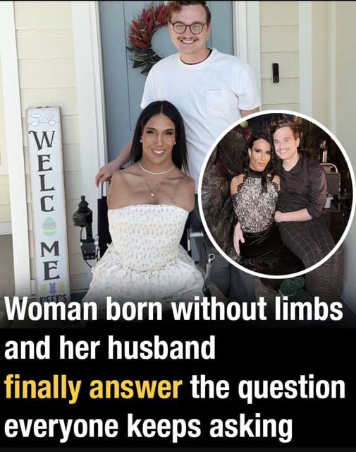 Woman born without limbs and her husband finally answer the question everyone keeps asking