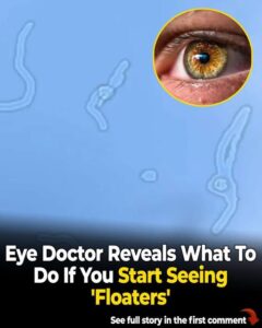 What Are Eye Floaters? Here What To Do If you Start Seeing Them, According to an Eye Doctor