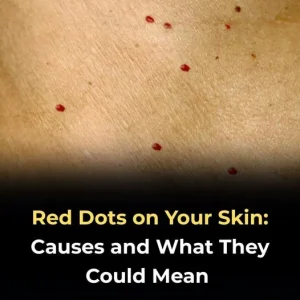 11 Reasons Why You Have Red Dots on Your Skin (And When to Worry)