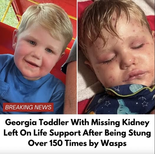 Georgia toddler stung over 150 times by yellow jackets, fighting for life