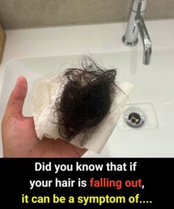 Did you know that if your hair is falling out, it can be a symptom of….