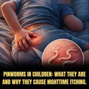 Understanding pinworms: Causes, symptoms, transmission, and how to get relief