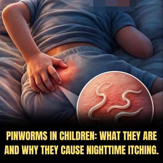 Understanding pinworms: Causes, symptoms, transmission, and how to get relief