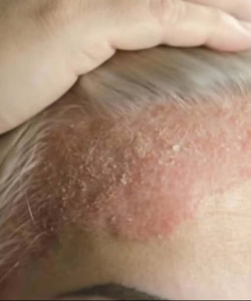These Are The Hidden Consequences of Sleeping With…