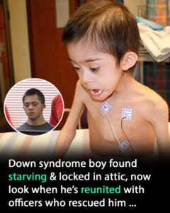 Boy with Down syndrome found starving and locked in attic is reunited with officers who rescued him