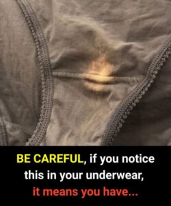 Why Underwear Discoloration Can Be a Sign of Health Changes