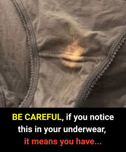 Why Underwear Discoloration Can Be a Sign of Health Changes