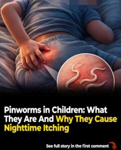 Pinworms In Children. What They Are And Why They Cause Nighttime Itching