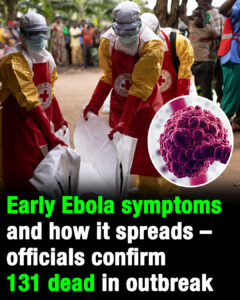 Ebola symptoms and how it spreads as officials confirm 131 dead in outbreak