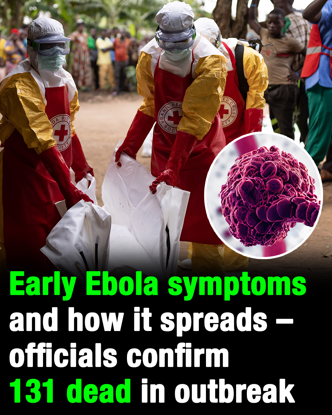 Ebola symptoms and how it spreads as officials confirm 131 dead in outbreak