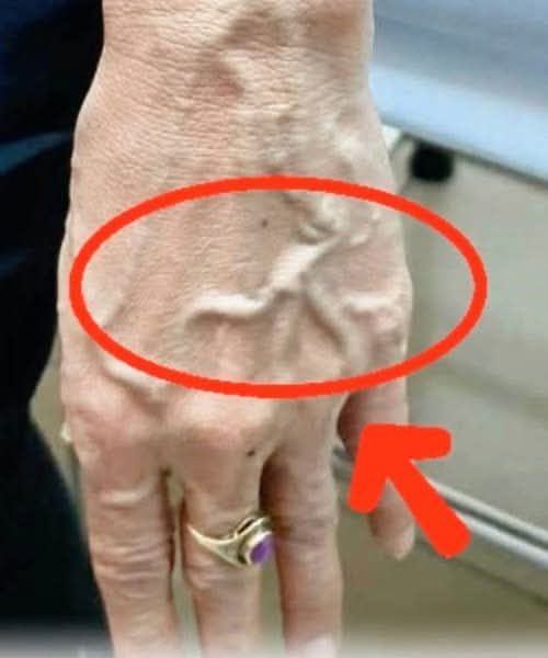 Why are your veins suddenly bulging and visible?
