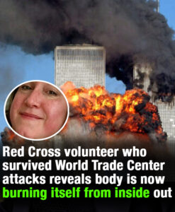 Woman who survived 9/11 terror attacks reveals body is now burning itself from inside out