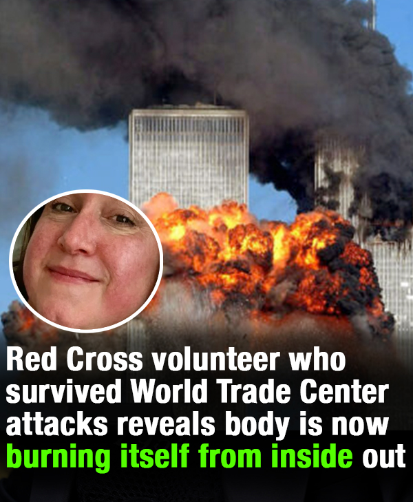 Woman who survived 9/11 terror attacks reveals body is now burning itself from inside out