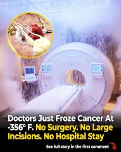 This MRI Machine Can ‘Freeze’ Cancer, Relieve Pain, and Boost Recovery