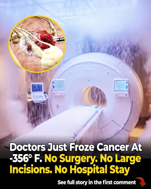 This MRI Machine Can ‘Freeze’ Cancer, Relieve Pain, and Boost Recovery