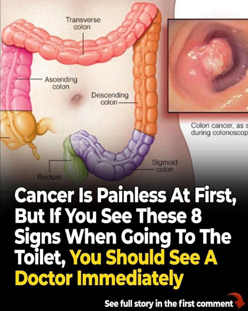 Weird Signs That Lead To a Cancer Diagnosis