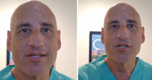 Heart surgeon warns everyone about eating food that ‘destroys your heart’ daily