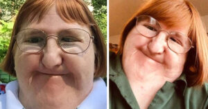 Bullied woman ‘too ugly’ for selfies takes one a day for a year