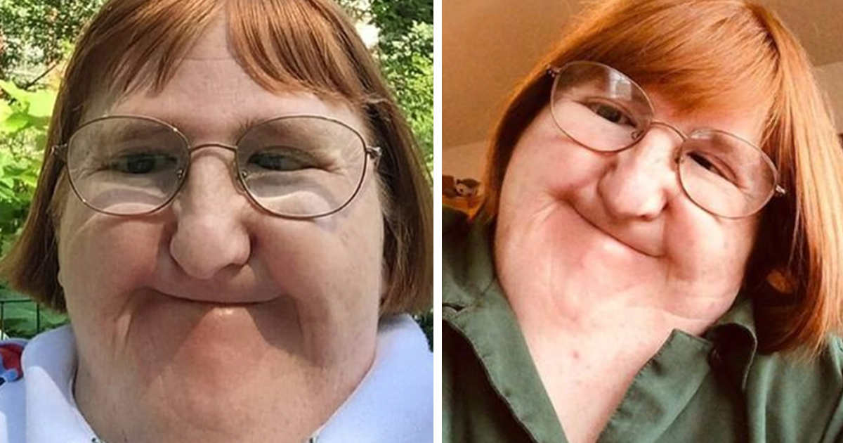 Bullied woman ‘too ugly’ for selfies takes one a day for a year