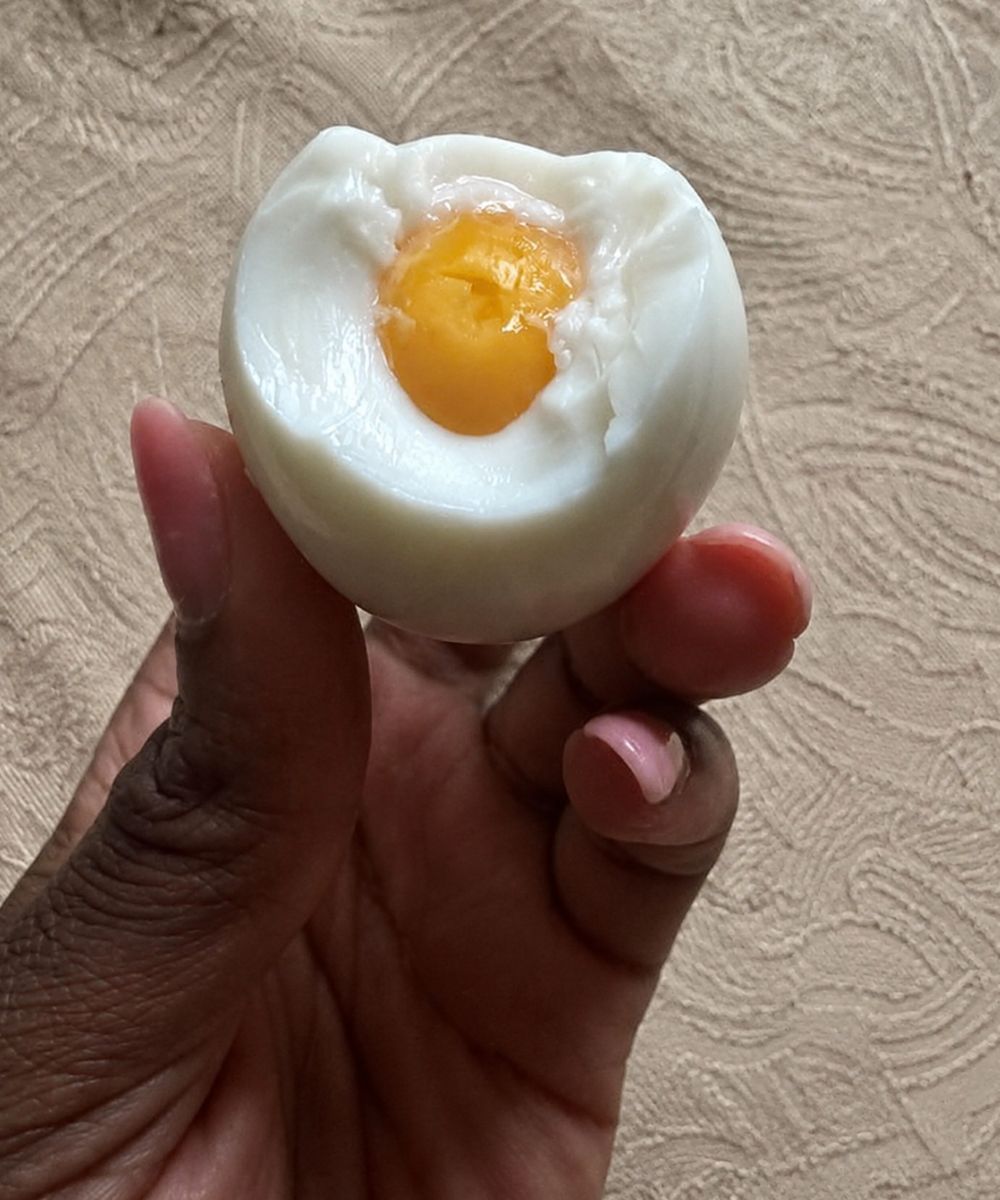 Nutritionists wa:rn that eating eggs every morning can cause…..